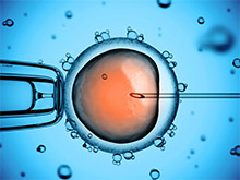 IVF, ICSI, PICSI, IUI