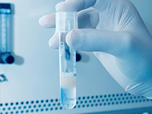Surgical Sperm removal