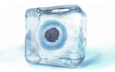 Fertility Preservation / Freezing