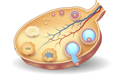 Ovulation Induction