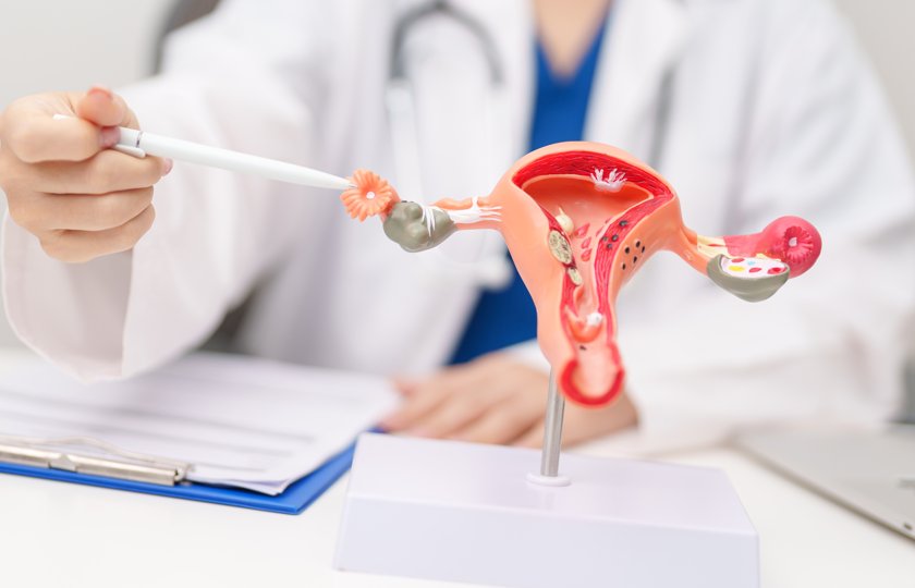 From PCOS to PMOS: What the Polyendocrine Metabolic Ovarian Syndrome name change means for our patients